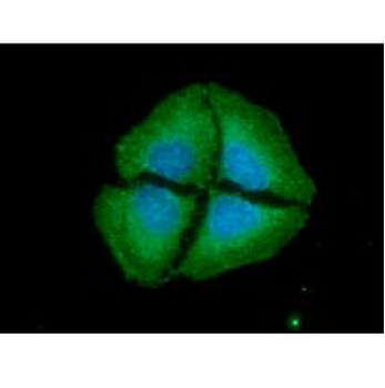 NT5E/eNT/CD73 Antibody