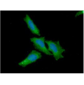 NFATC1/NFAT2 Antibody