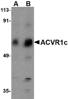 ACVR1C/ALK7 Antibody