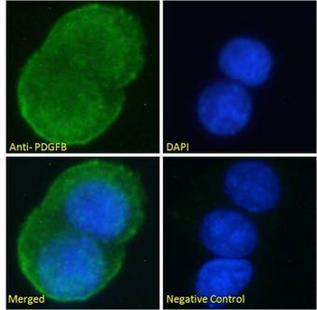 PDGF-BB Antibody