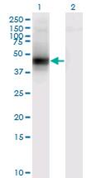 DCN/Decorin Antibody
