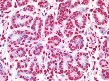 NALP3/NLRP3 Antibody