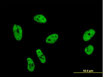 SF1 Antibody