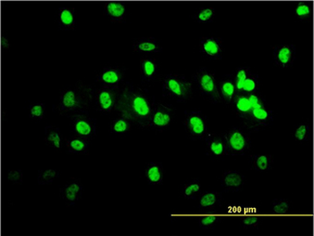 TDP-43/TARDBP Antibody