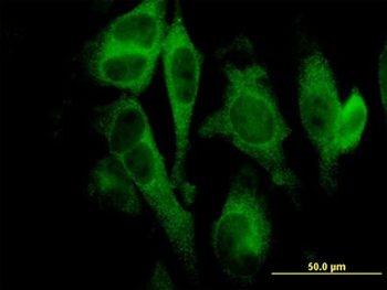 Gasdermin D/GSDMD Antibody