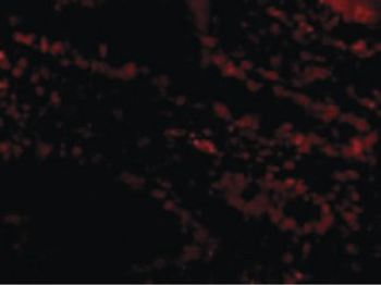 BIRC7/Livin Antibody