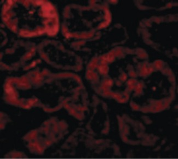 NIX/BNIP3L Antibody
