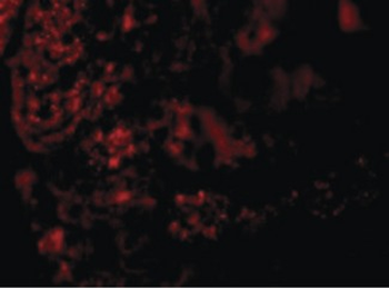 AGTR1/AT1 Receptor Antibody
