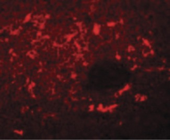 SQSTM1 Antibody