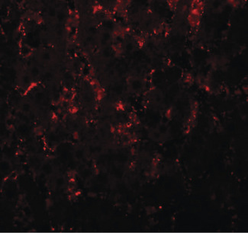NR1H3/LXR Alpha Antibody