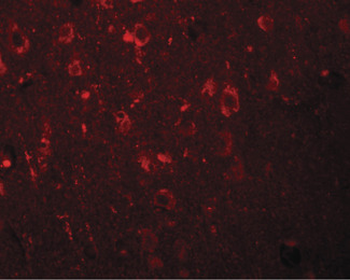 EFHD2 Antibody