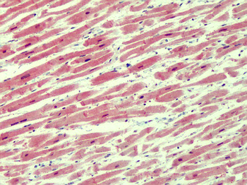IRAK4/IRAK-4 Antibody