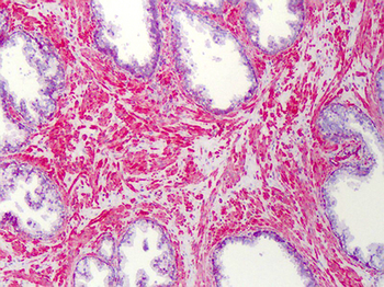 SLC5A3 Antibody