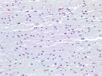 FPR1/FPR Antibody