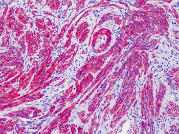 ACTG2 Antibody