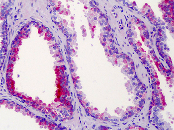 ST14/Matriptase Antibody
