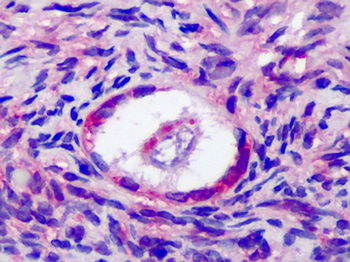 FSH Receptor/FSHR Antibody