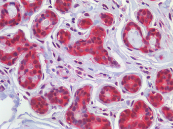 SMO/Smoothened Antibody