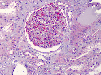 NALP3/NLRP3 Antibody