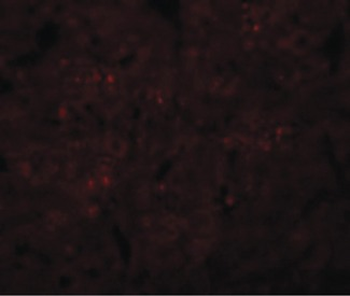 SYNGR3/Synaptogyrin 3 Antibody
