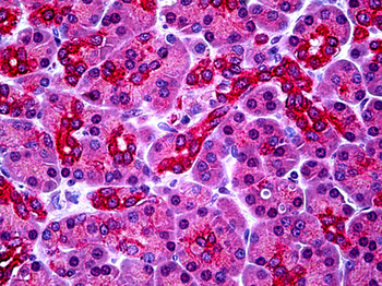 PARL/PSARL Antibody