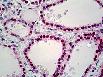 HMGN2 Antibody
