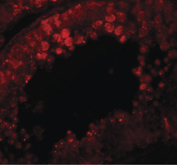 CRISP2/TSP1 Antibody