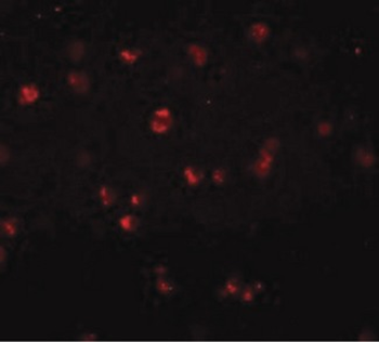 NOD3/NLRC3 Antibody