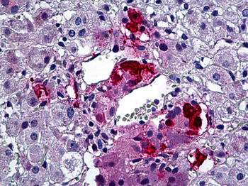 TH/Tyrosine Hydroxylase Antibody