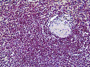 CDK6 Antibody