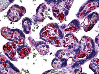 FGF1/Acidic FGF Antibody