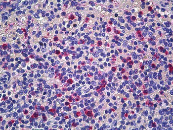 CD177 Antibody