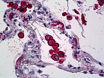Mannose Receptor/CD206 Antibody