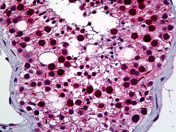 NEK2 Antibody