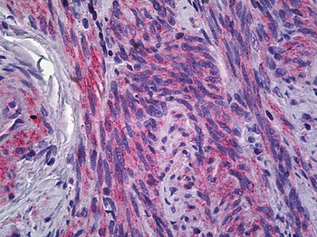 CD225/IFITM1 Antibody