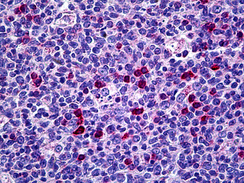 CIITA Antibody