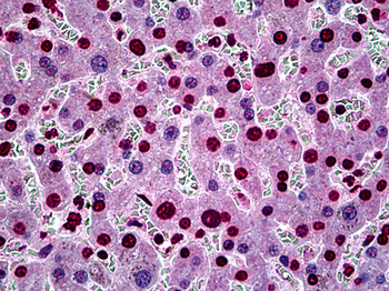 SGK1/SGK Antibody