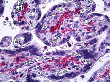 MMP11 Antibody