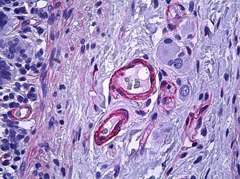 ETK/BMX Antibody