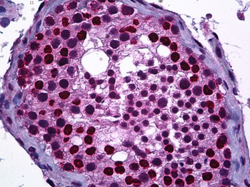 DNMT3B Antibody