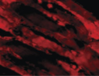 IL31 Antibody