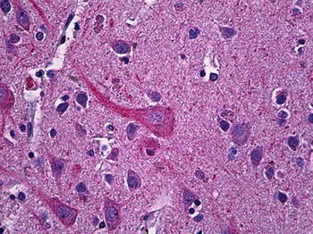 SYT1/Synaptotagmin Antibody