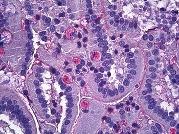 NTN1/Netrin 1 Antibody
