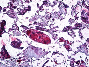 DGAT1 Antibody