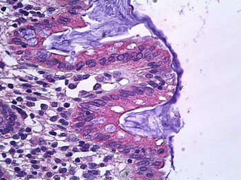 SLC12A2/NKCC1 Antibody