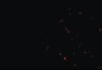 TP1/TEP1 Antibody