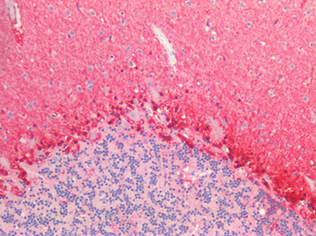 ALDH1A1/ALDH1 Antibody