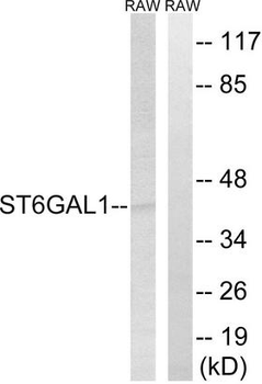 ST6GAL1/CD75 Antibody