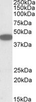 CXCR6 Antibody
