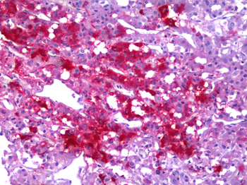 Neuropeptide Y/NPY Antibody